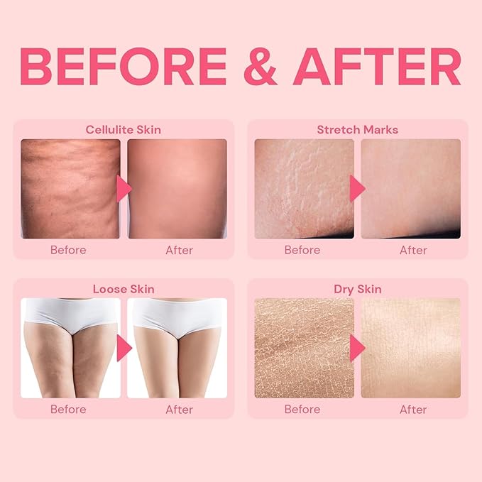 Anti Cellulite Body Firming Cream: Cellulite Remover for Legs & Inner Thigh- Skin Tightening Lotion for Womens' Booty, Stomach & Belly with Acetyl Hexapeptide-8 & Caffeine, 100 ML