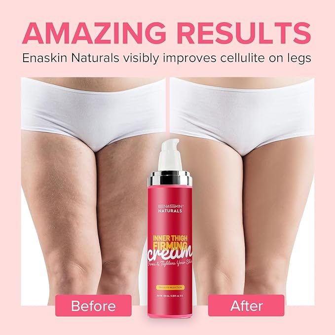 Anti Cellulite Body Firming Cream: Cellulite Remover for Legs & Inner Thigh- Skin Tightening Lotion for Womens' Booty, Stomach & Belly with Acetyl Hexapeptide-8 & Caffeine, 100 ML